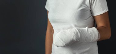 Koyu gri arka planda alçılı bir kadın. Kızın beyaz tişört giyen kırık bir eli var.