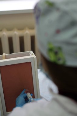 Plevral ponksiyon veya torakosentez, acil manipülasyon.