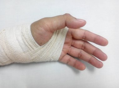 MALACCA, MALAYSIA - 09 Mart 2016: Sol bilek yaralanması ve bandajla sarma