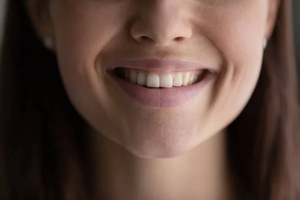 Glückliche junge Frau zeigt perfektes Lächeln mit weißen geraden Zähnen. — Stockfoto