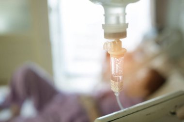 İntravenöz için sodyum klorür solüsyonu, tuzlu su, tıbbi tedavi, salin damar yolu.