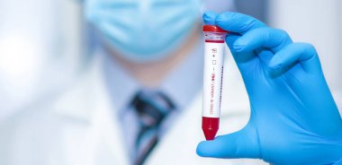 Doktorun elinde IHU varyantı ya da COVID-19 virüsü içeren bir test tüpü var..
