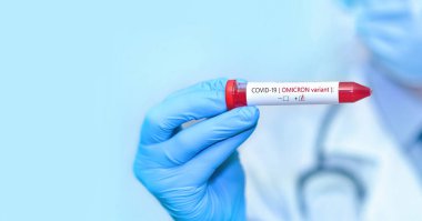 Doktorun elinde Omicron varyantı ya da COVID-19 virüsü taşıyan bir test tüpü var..