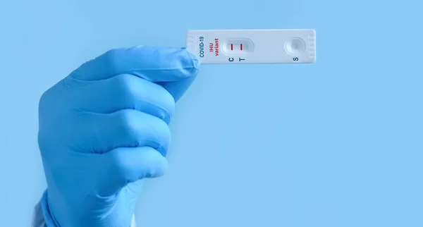Läkarens Hand Medicinska Handskar Visar Ett Snabbt Laboratorietest För Covid — Stockfoto