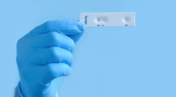 Ręka Lekarza Rękawicach Medycznych Kasetą Szybkiego Testu Obecność Wirusa Zapalenia — Zdjęcie stockowe