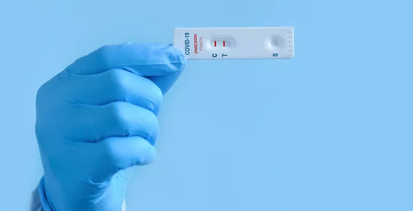Ręka Lekarza Ochronnych Rękawicach Medycznych Wykazuje Szybki Test Laboratoryjny Obecność — Zdjęcie stockowe