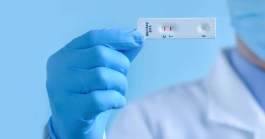 Koruyucu maske ve eldiven takan bir doktor veya hemşire, yeni koronavirüsün IgM ve IgG antikorlarını tespit etmek için hızlı bir Maymun Çiçeği Virüsü (MPXV) testi gösteriyor. Pozitif sonuç