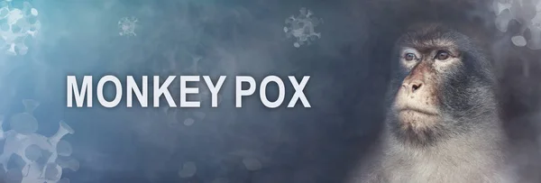 Monkeypox 2022 Virus Monkeypox Outbreak Concept Monkeypox Viral Zoonotic Disease — 스톡 사진
