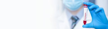 Doctor holding a test blood sample tube with  monkey pox virus (MPXV). Banner. Copy space