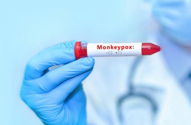 Doctor holding a test blood sample tube with monkey pox virus (MPXV).Banner. Copy space for text