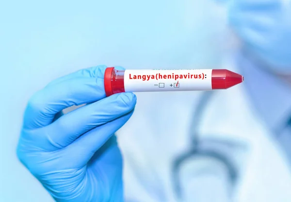 Доктор Тримає Пробірку Крові Позитивною Трубкою Langya Henipavirus Layv Вірус — стокове фото