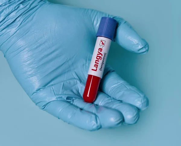 Доктор Тримає Пробірку Крові Позитивною Лангья Геніпавірусом Layv Вірус Передається — стокове фото