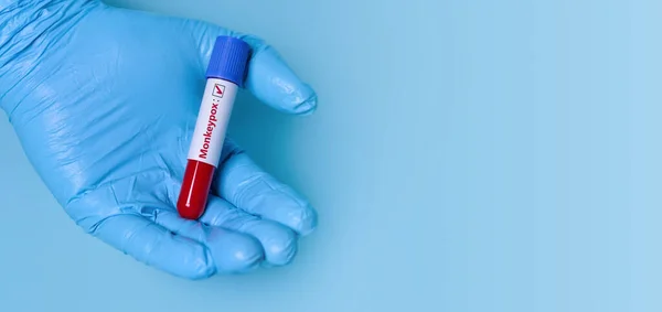 Doctor Holding Test Blood Sample Tube Positive Monkeypox Virus Mpxv —  Fotos de Stock