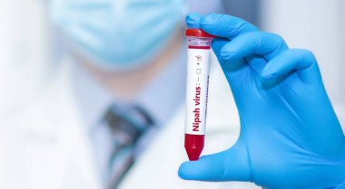 Doctor holding a test blood sample tube with positive Nipah.The virus is transmitted from animals to humans or through contaminated food, it can also be transmitted directly from person to person