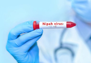 Doctor holding a test blood sample tube with positive Nipah.The virus is transmitted from animals to humans or through contaminated food, it can also be transmitted directly from person to person