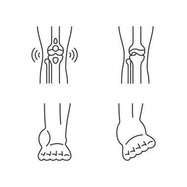 Artrit bacak ağrısı doğrusal ikonlar ayarlandı. Dejeneratif eklem hastalığı. Bursitis durumu. Kas gerilimi. Özelleştirilebilir ince çizgi şekilleri. İzole vektör çizimi çizimleri. Düzenlenebilir vuruş