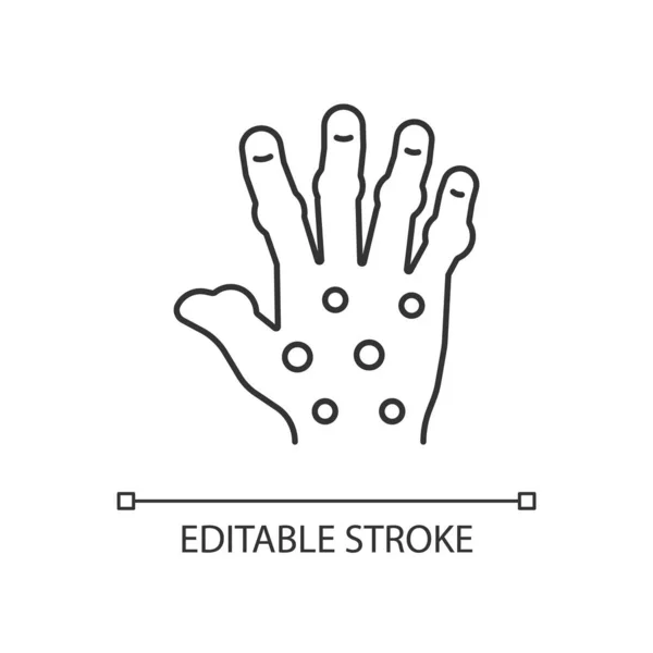 Линейная Икона Псориатического Артрита Больные Пальцы Суставы Рук Постоянное Повреждение — стоковый вектор