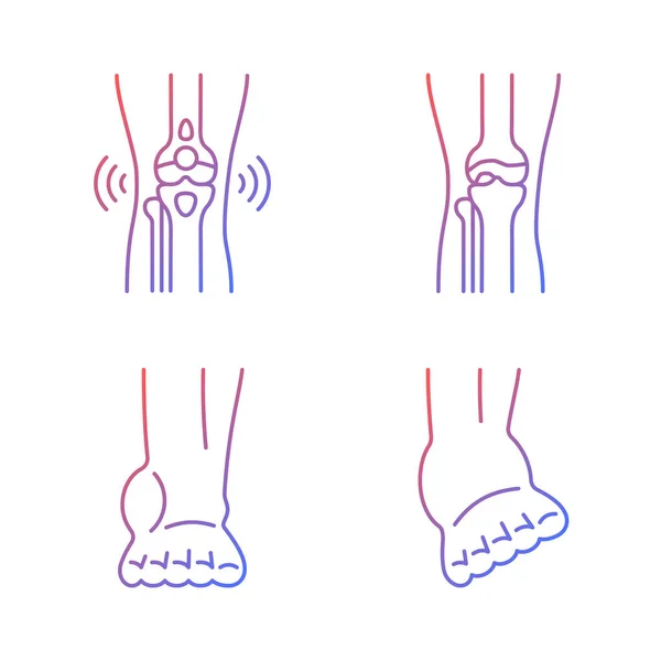 Artritis Been Pijn Gradiënt Lineaire Vector Pictogrammen Ingesteld Degeneratieve Gewrichtsziekte — Stockvector