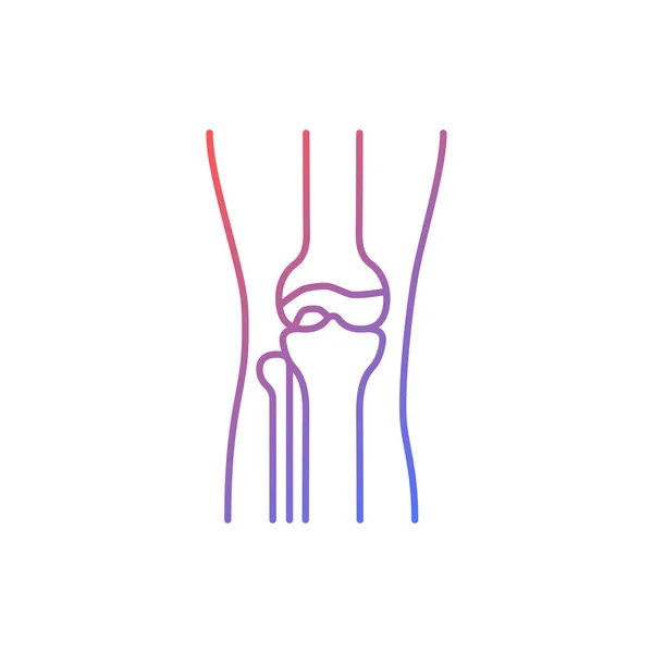 Artrose Gradiënt Lineaire Vector Pictogram Kraakbeenontsteking Degeneratieve Gewrichtsziekte Pijn Knie — Stockvector