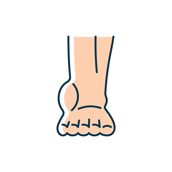 Knöchelentzündung Geschwollener Fuß Und Knöchel Arthrose Entwicklung Weichteilverletzungen Muskelkater Knöchel — Stockvektor
