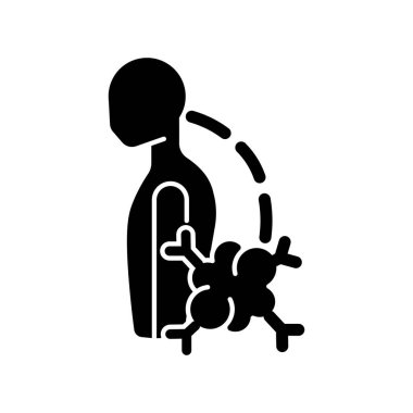 Patolojik skolyoz siyah sembol. İyi huylu kemik tümörü. Omurga yana sapması. Omurga eğriliği. Omurga deformasyonu. Beyaz uzayda siluet sembolü. Vektör izole illüstrasyonu