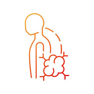 Patolojik skolyoz gradyan doğrusal vektör ikonu. İyi huylu kemik tümörü. Omurga yana sapması. Omurga eğriliği. İnce çizgi renk sembolü. Modern tarz pictogram. Vektör izole çizimi