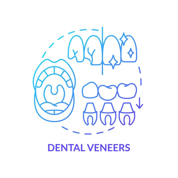 Diş Kaplamaları Mavi Gradyan Konsept Ikonu Estetik Dişçilik Türü Soyut — Stok Vektör