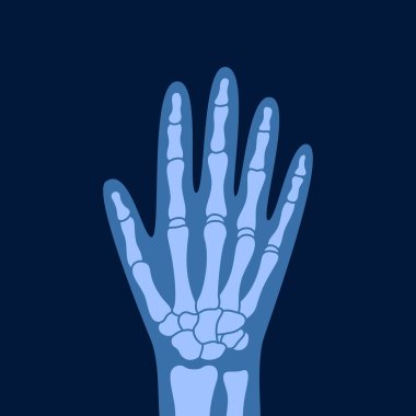 İnsan el kemiklerinin röntgeni. İnsan eklem anatomisi x ışını vektör çizimi. Tıbbi, eğitici ve bilimsel illüstrasyon.