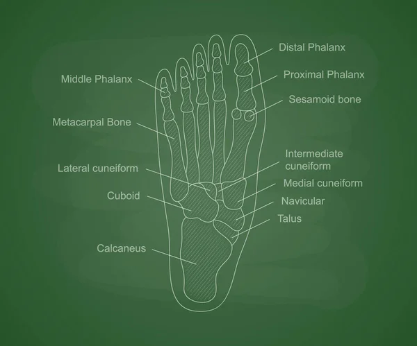 人間の足の骨の解剖図だ 医学大学の教育内容 骨の説明と人間の足の図 ベクターイラスト — ストックベクタ