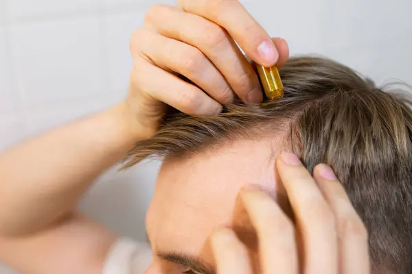 Middle aged caucasian white man uses, applies to hair with cosmetic ampoules with serum for hair growth, restoration beauty hair. The concept of the problem of male hair loss, baldness and alopecia.