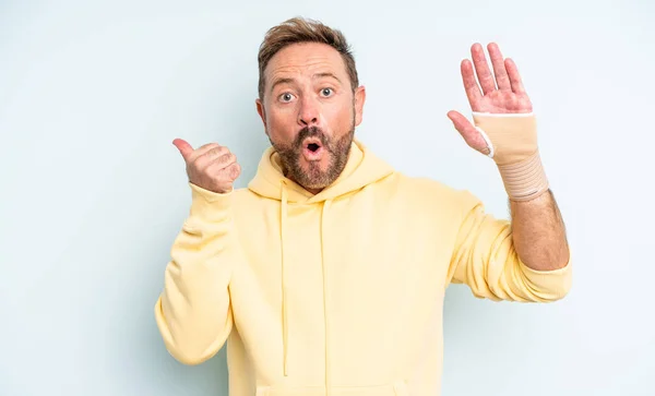 Middelbare Leeftijd Knappe Man Kijkt Verbaasd Ongeloof Gebroken Hand Concept — Stockfoto