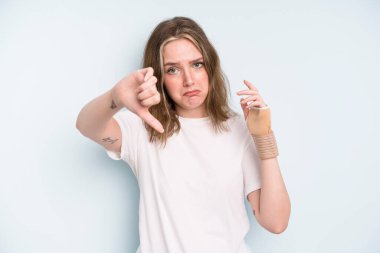 caucasian pretty woman feeling cross,showing thumbs down. broken hand concept