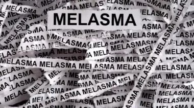 Melasma. Üzerinde Melasma yazan yırtık bir kağıt parçası..