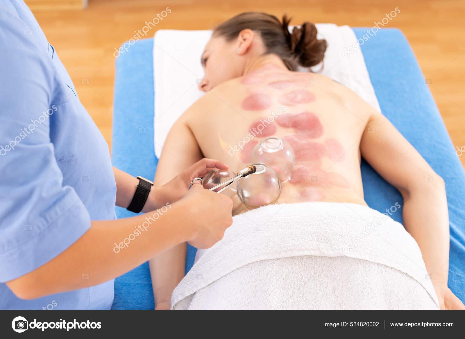 Antecedentes Terapia Ventosa Vacío Fisioterapeuta Aplicando