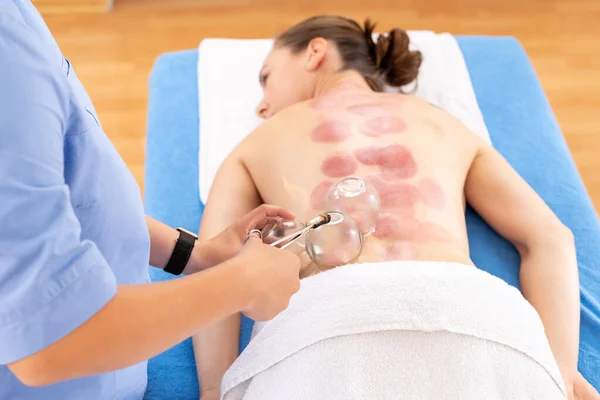 Vacuum Cupping Therapy Background. Physiotherapist applying suction cups on the back of her patient, to relieve muscle pain, top view close up shot.