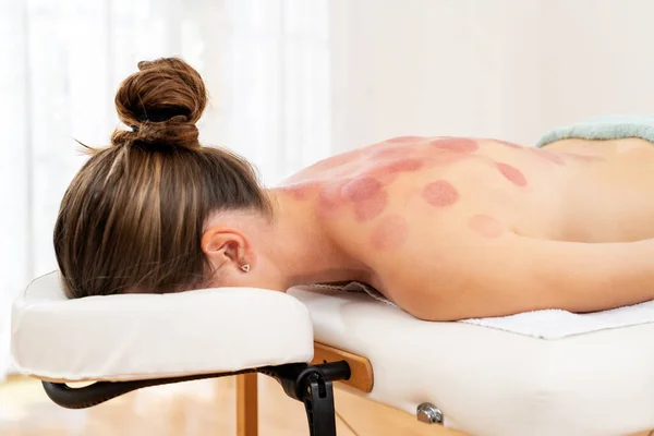 Vaccum Cupping Therapy. Treatment used in Traditional Chinese Medicine for pain relief and other health benefits. Woman Relaxing After Cupping Treatment At a Spa.