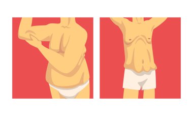 Sarkık Göbekli Erkek Gövde ve Yumuşak Kas Vektörü Ayarları