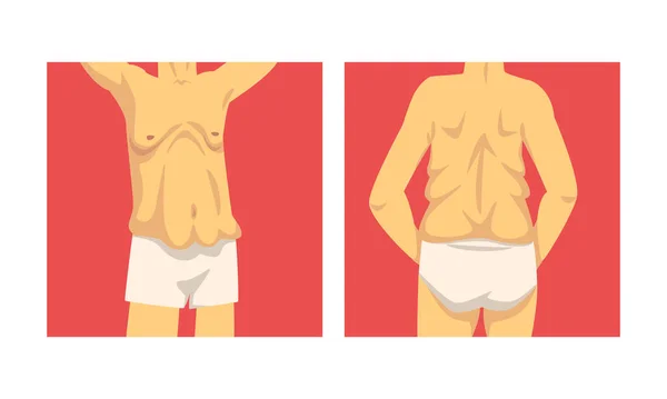 Männlicher Torso mit schlaffem Bauch und weichen Muskeln — Stockvektor