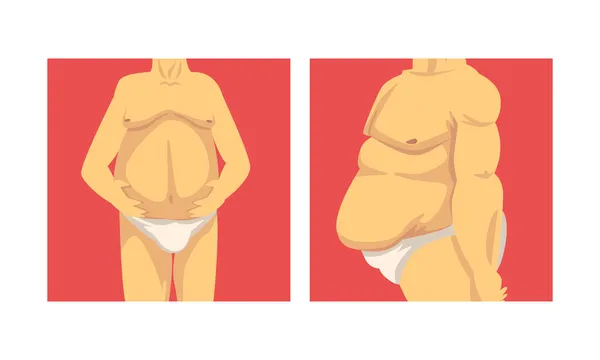 Mužské trup s povislým břichem a měkké svaly vektor sada — Stockový vektor