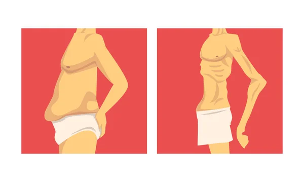 Männlicher Torso mit schlaffem Bauch und weichen Muskeln — Stockvektor