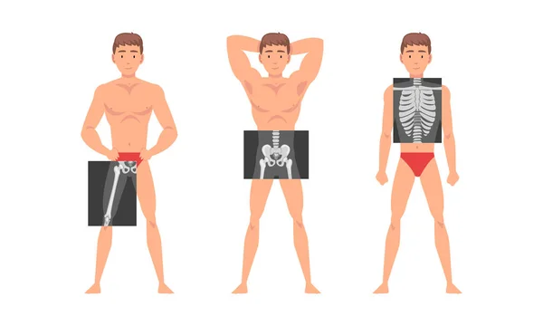 Young Man Standing in Undershorts with His Skeleton X-ray Vector Set — Stockvector