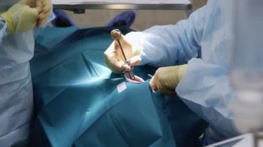 Profesyonel doktorlar diş cerrahisi yapıyor, hastaların ağzındaki dişleri tedavi ediyor. Cerrahi operasyon. Dişçilik.