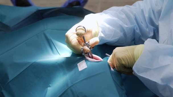 Medici professionisti che effettuano interventi chirurgici dentali, curando i denti nella bocca dei pazienti. Operazione chirurgica. Odontoiatria. — Video Stock