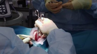 Profesyonel doktorlar diş cerrahisi yapıyor, hastaların ağzındaki dişleri tedavi ediyor. Cerrahi operasyon. Dişçilik.