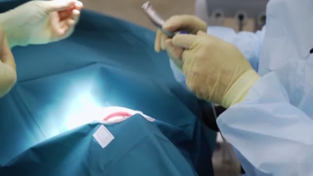 Medici professionisti che effettuano interventi chirurgici dentali, curando i denti nella bocca dei pazienti. Operazione chirurgica. Odontoiatria. — Video Stock