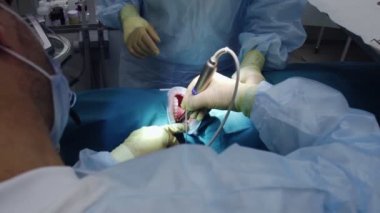 Profesyonel doktorlar diş cerrahisi yapıyor, hastaların ağzındaki dişleri tedavi ediyor. Cerrahi operasyon. Dişçilik.