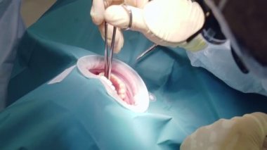 Profesyonel doktorlar diş cerrahisi yapıyor, hastaların ağzındaki dişleri tedavi ediyor. Cerrahi operasyon. Dişçilik.