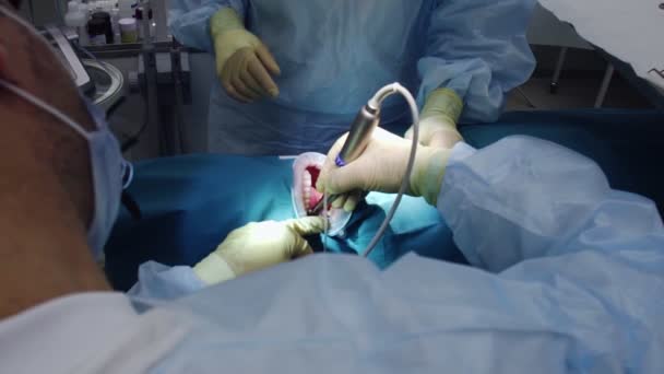 Professionelle Ärzte, die zahnärztliche Operationen durchführen und Zähne im Mund des Patienten behandeln. Operative Operation. Zahnmedizin. — Stockvideo