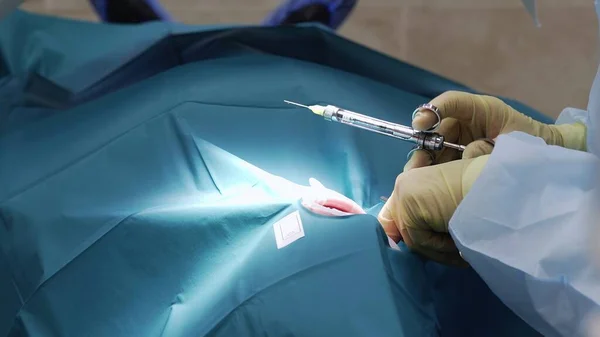 Професійні лікарі проводять стоматологічну хірургію, лікують зуби в роті пацієнтів. Хірургічна операція. стоматології . — стокове фото
