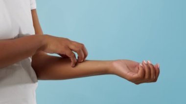 Unrecognizable African Woman Scratching Itchy Arm Over Blue Background, Cropped